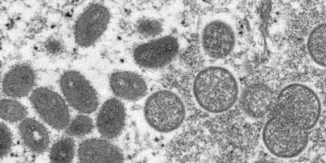 What Is Monkeypox and Where Is It Spreading?