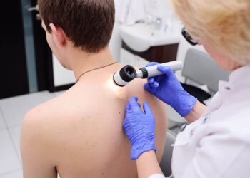 Allina Health resumes free skin cancer screenings as cases surge